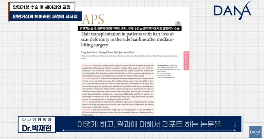 안면거상술 후 흉터와 헤어라인 변형, 자연스럽게 해결하는 방법 관련 이미지 5