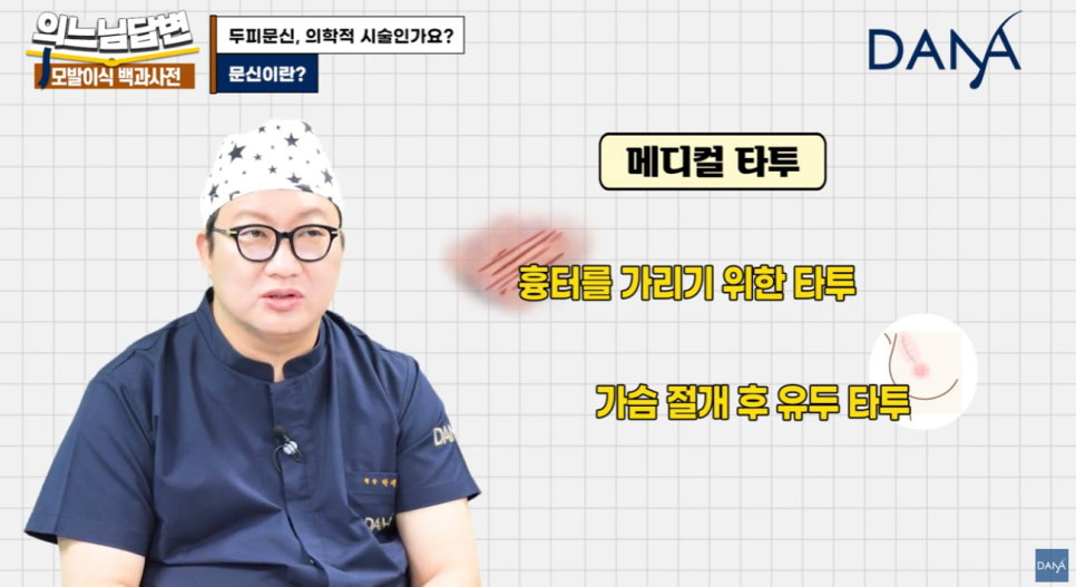두피문신, 단순 타투일까 의학적 시술일까? 관련 이미지 9