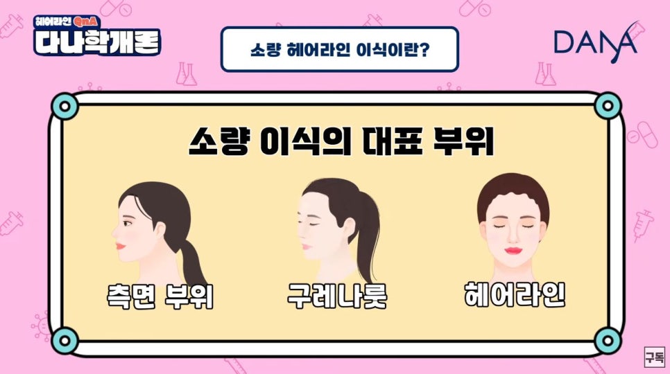 헤어라인교정 소량(적은모수)으로도 가능할까 관련 이미지 11