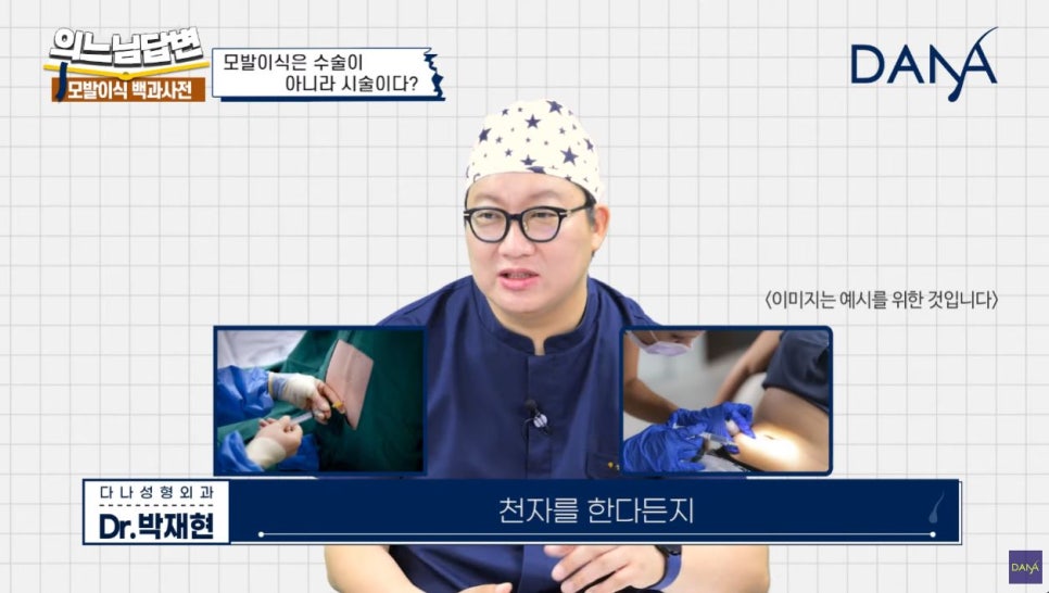 모발이식, 수술일까? 시술일까? 관련 이미지 3