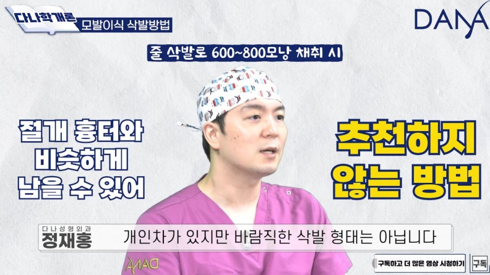 모발이식 수술 시 삭발 종류 관련 이미지 9