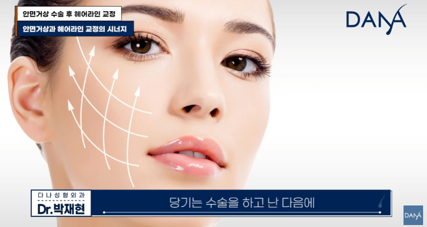 안면거상술 후 흉터와 헤어라인 변형, 자연스럽게 해결하는 방법 관련 이미지 2