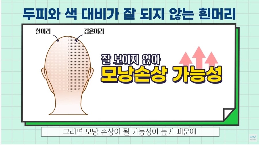 Checklist to Prepare Before Hair Transplant Surgery image 5