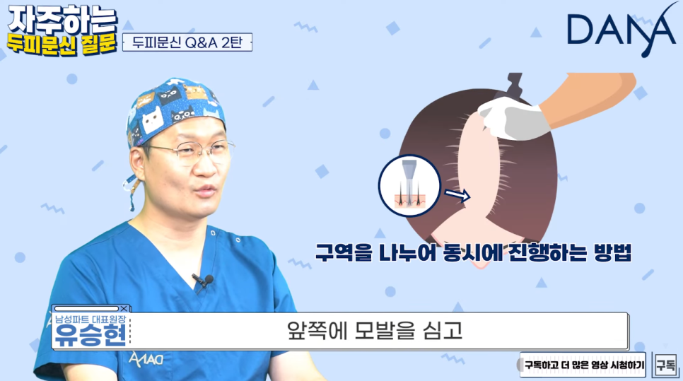 Can Scalp Micropigmentation and Hair Transplantation Be Done at the Same Time? image 3