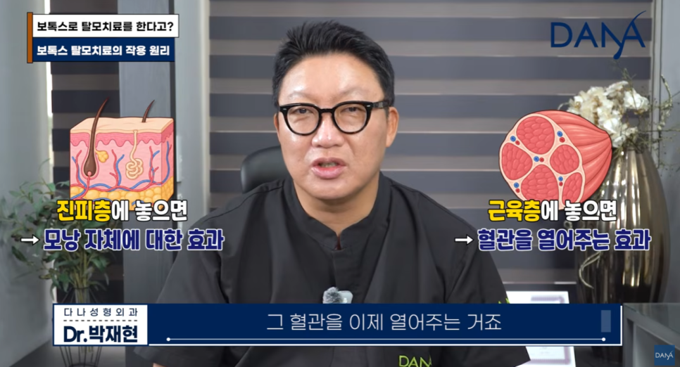 여성 탈모 치료, 먹는 약 대신 두피 보톡스 맞아야 하는 이유 관련 이미지 13