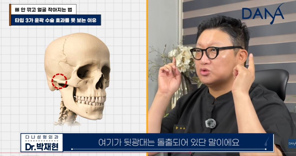 뼈 안 깎고 얼굴 작아지는 법? 광대 수술 효과 없는 관련 이미지 13