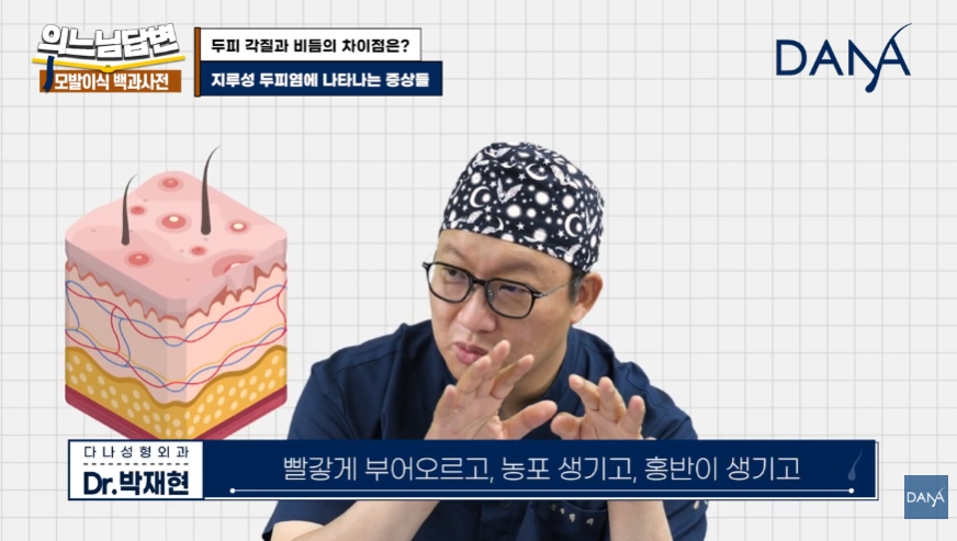 머리 잘 감아도 비듬 생기는 뜻밖의 원인! 두피 각질 차이 및 해결법 관련 이미지 11