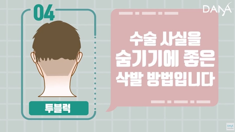비절개 모발이식 시 삭발방법 종류 관련 이미지 8
