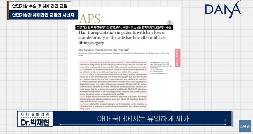 안면거상술 후 흉터와 헤어라인 변형, 자연스럽게 해결하는 방법 관련 이미지 4