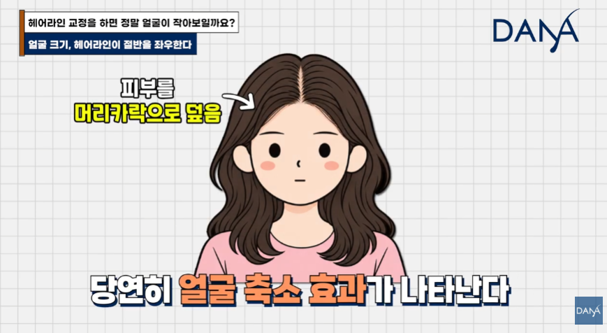 넙데데한 얼굴이 고민이라면? 상위 1% 원장님이 말하는 진짜 안면 축소술 관련 이미지 10