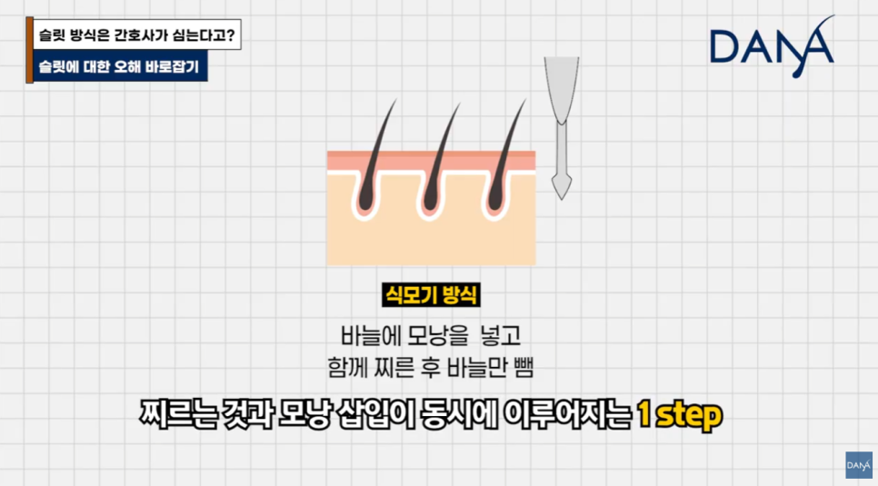 슬릿 방식은 간호사가 심는다? 모발이식 슬릿 vs 식모기 차이점 완벽 정리 관련 이미지 5