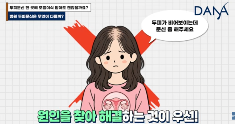 헤어라인 문신 망했는데 모발이식 가능할까? 생착률 걱정된다면 필수 체크 관련 이미지 8
