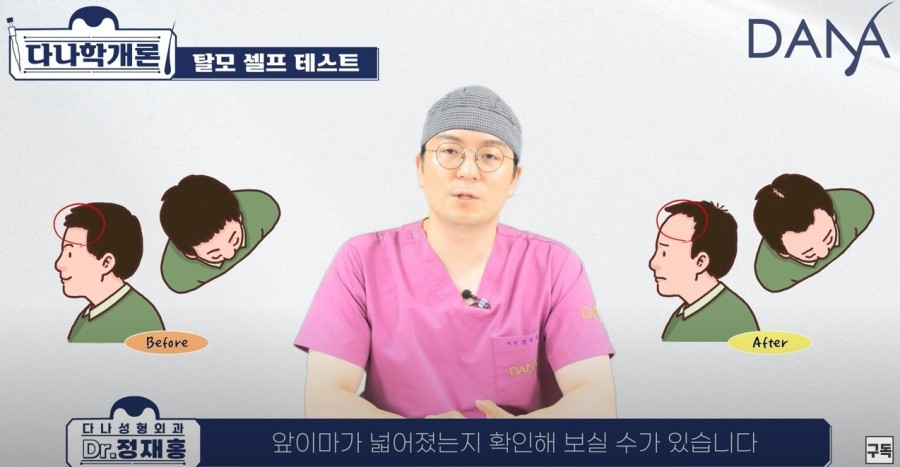 If Your Hair Falls Out Often: A Self-Check Method for Hair Loss image 3