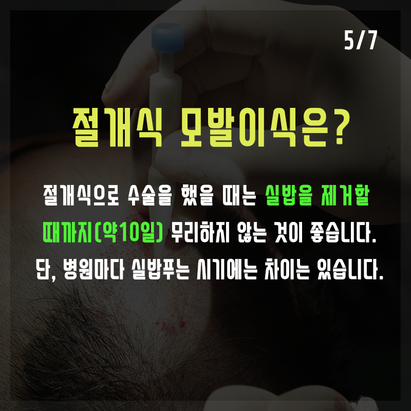 Q. 모발이식 수술 후 피해야 할 것들은? 관련 이미지 5