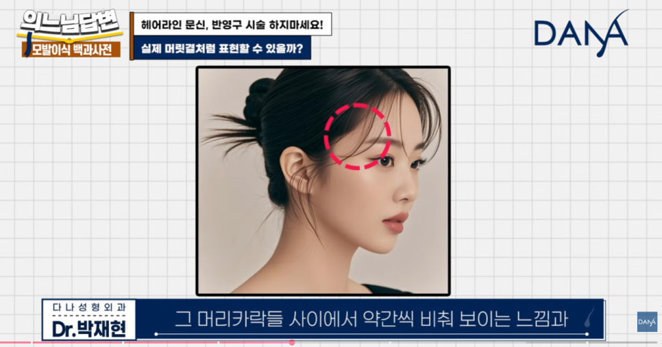 Why You Should Never Get a Hairline Scalp Tattoo image 5
