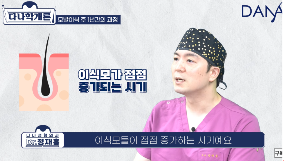 모발이식 1년후 (수술후 머리카락이 자라나는 과정) 관련 이미지 10