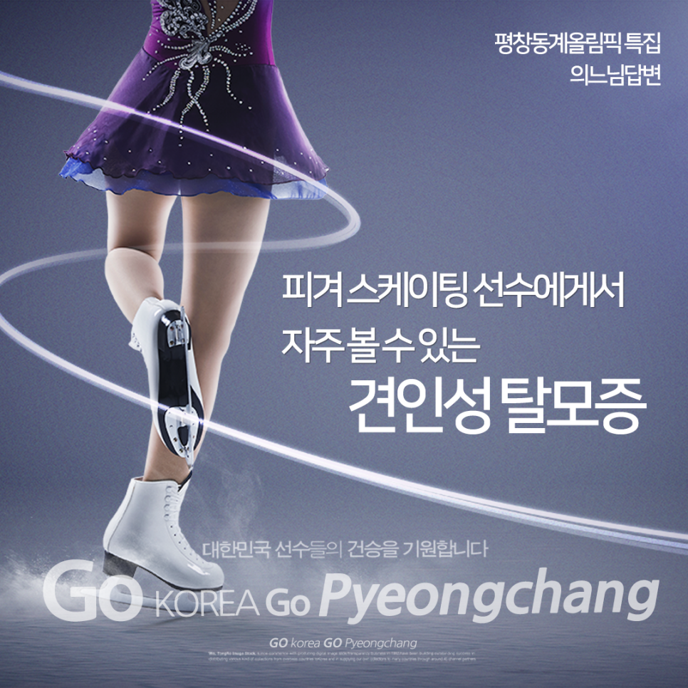 머리를 세게 묶어 오는 견인성 탈모 관련 이미지 1