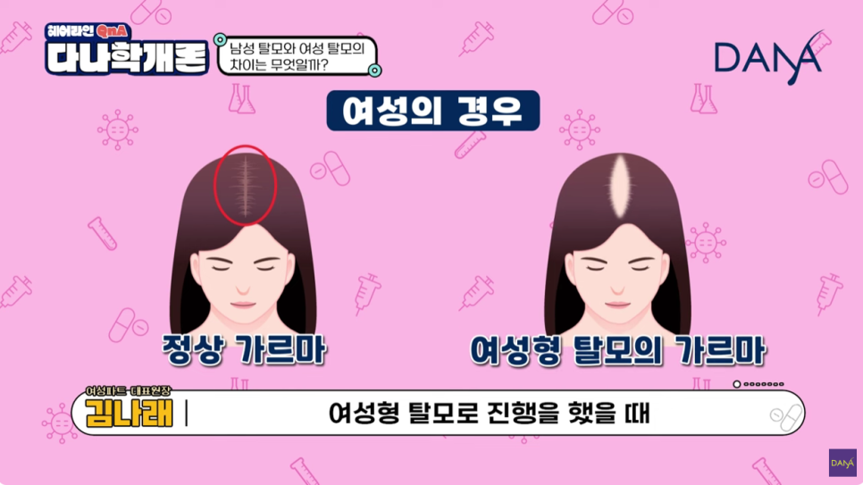 여성탈모원인 파악하고 제대로 치료하세요 관련 이미지 3