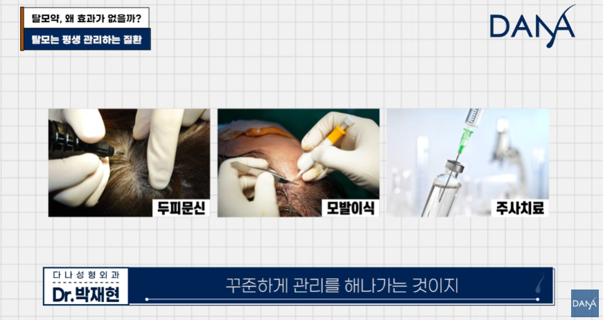 한두 달 먹고 효과 없다고 탈모약 끊은 분들 100% 후회합니다 관련 이미지 15