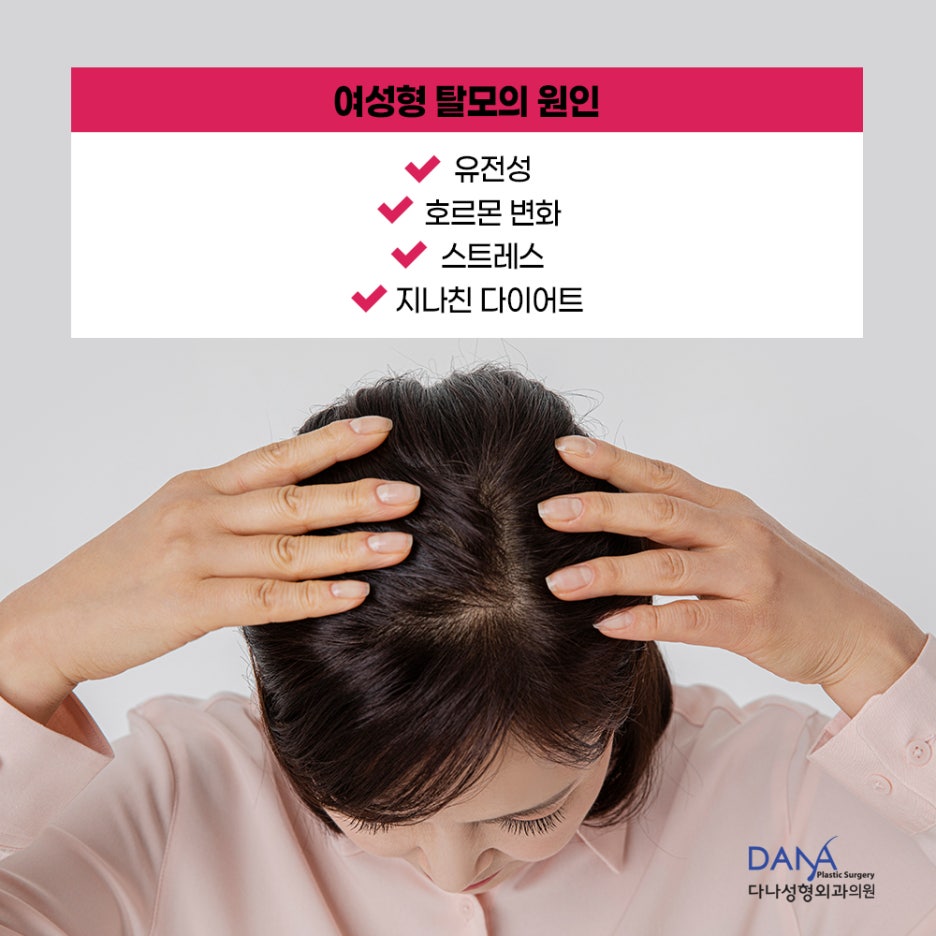 젊다고 안심? 여성 탈모도 빠른 치료가 필요 할수있습니다 관련 이미지 3