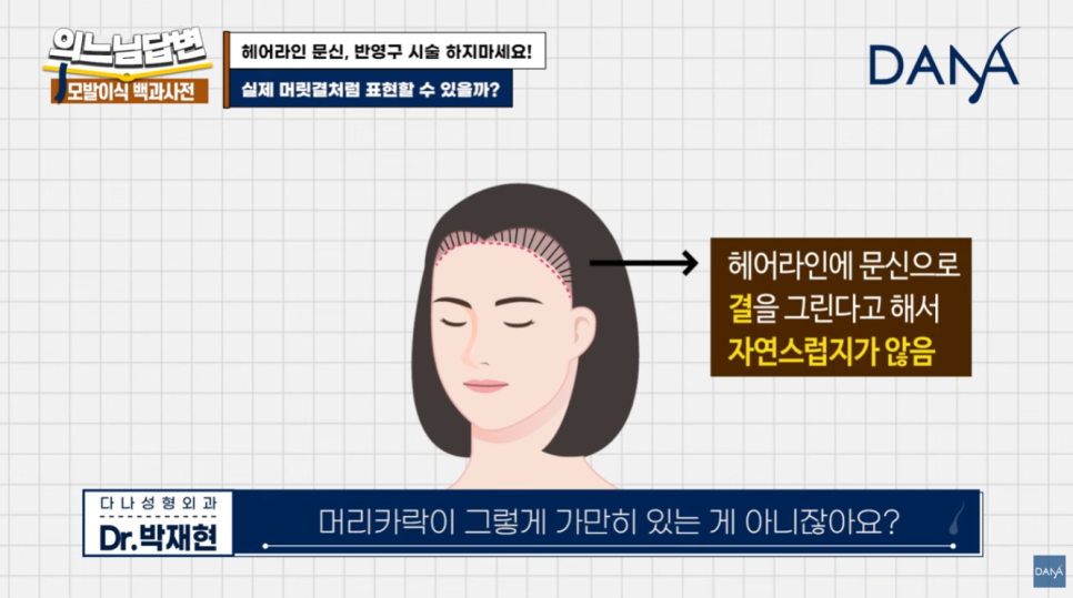 Why You Should Never Get a Hairline Scalp Tattoo image 3