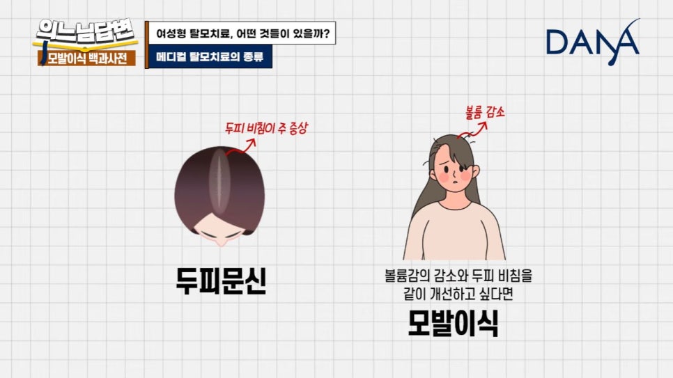 Women’s Hair Loss Treatment: Types of Treatment Methods image 6