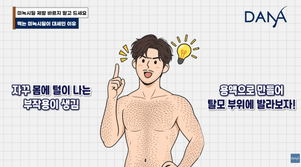 먹는 미녹시딜 vs 바르는 미녹시딜, 나에게 맞는 완벽 선택 가이드 관련 이미지 4