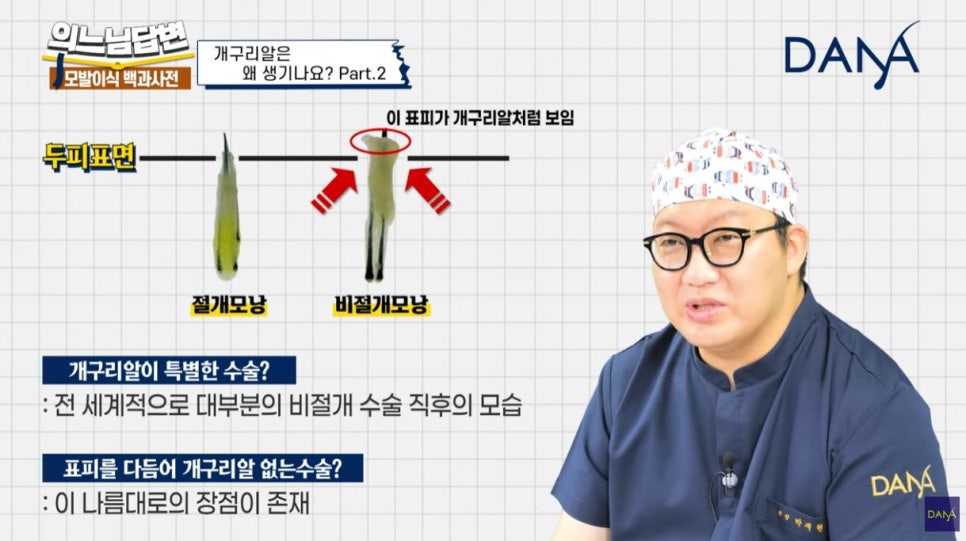 모발이식 개구리알 생기는 이유_2편 관련 이미지 2