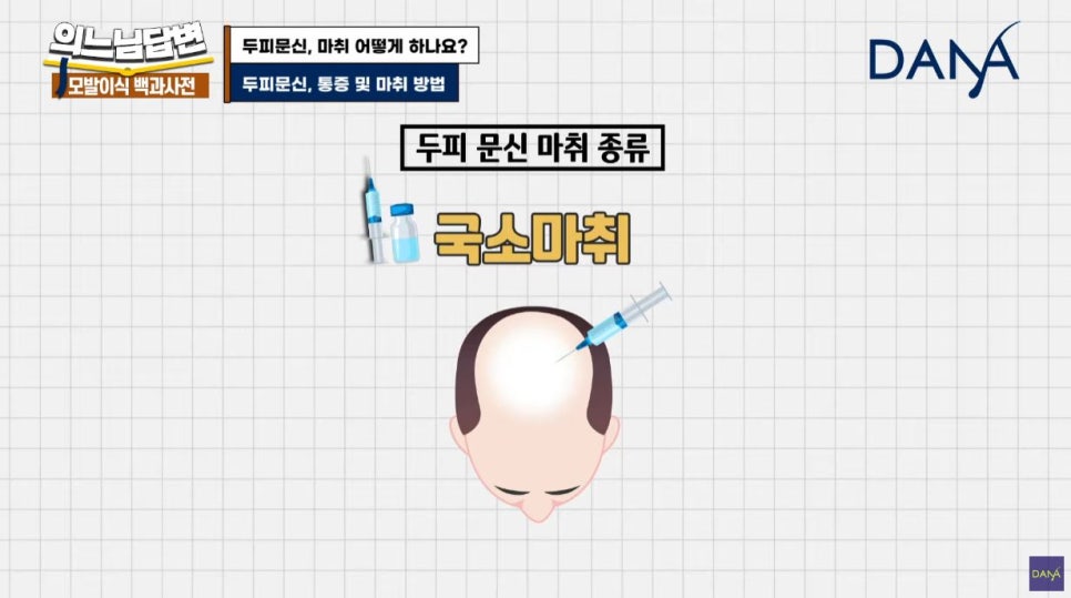 두피문신, 마취는 어떻게 하나요? 관련 이미지 6