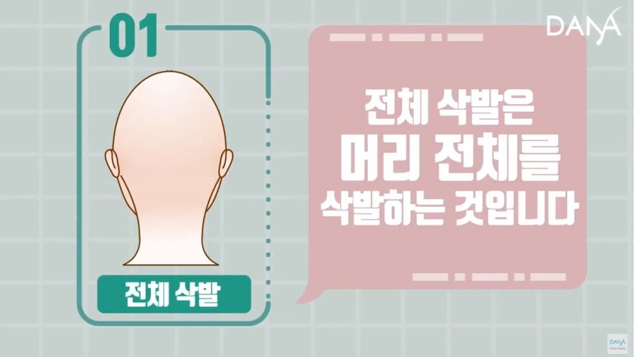 비절개 모발이식 시 삭발방법 종류 관련 이미지 4