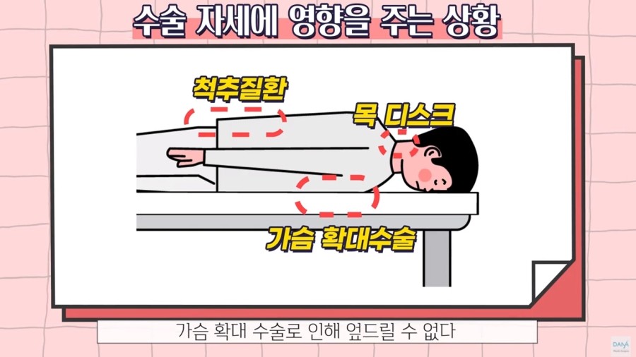 모발이식수술 전 미리 병원에 꼭 알려야할 체크리스트 관련 이미지 5