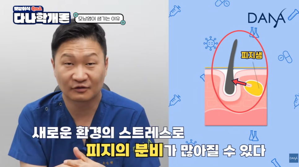 모발이식 후 모낭염, 수술 실패일까? 원인과 대처 꿀팁! 관련 이미지 6