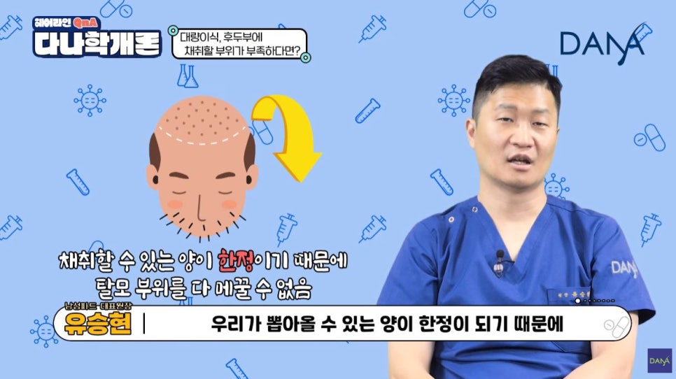 대량이식, 채취할 모발이 부족하면 어떻게 해야할까? 관련 이미지 6