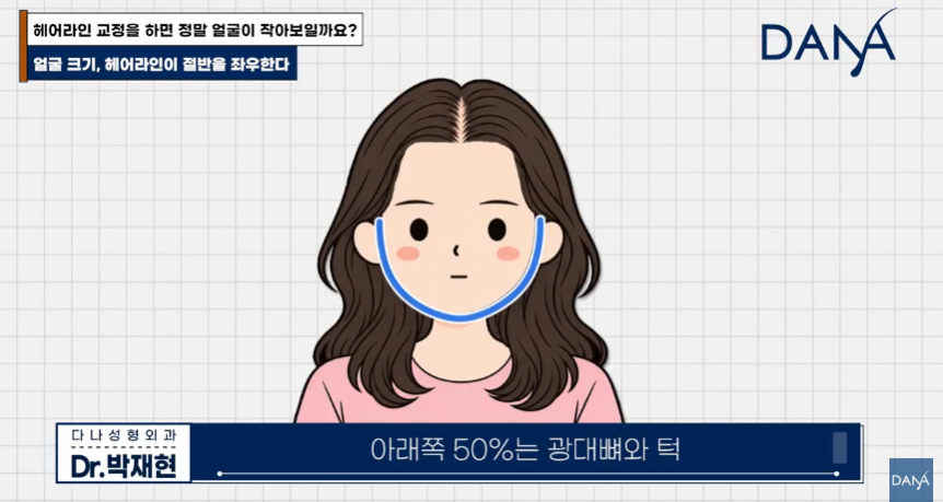 넙데데한 얼굴이 고민이라면? 상위 1% 원장님이 말하는 진짜 안면 축소술 관련 이미지 14