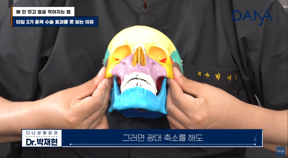 뼈 안 깎고 얼굴 작아지는 법? 광대 수술 효과 없는 관련 이미지 12