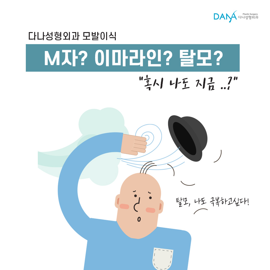 Male Hair Loss: Another Way to Overcome It Is Hair Transplantation image 1