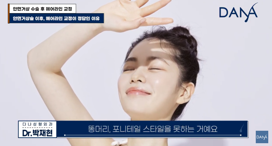 안면거상술 후 흉터와 헤어라인 변형, 자연스럽게 해결하는 방법 관련 이미지 19