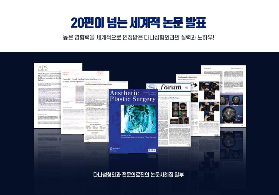 다나성형외과 "민머리두피문신" 전세계에서 가장 많은 다운로드를 기록한 논문 선정 관련 이미지 2