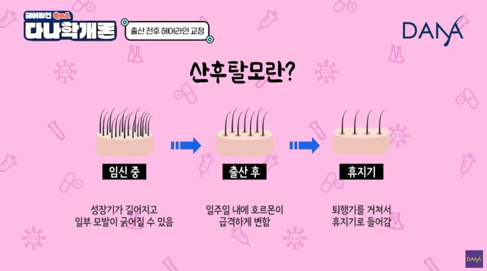 산후탈모 출산 후 생기는 이유와 헤어라인교정 시기는? 관련 이미지 10