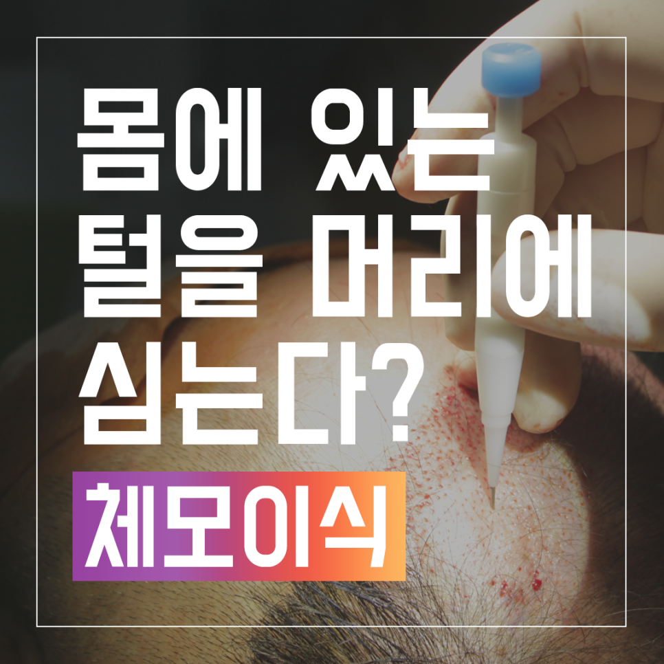 Put Body Hair on the Head? Body Hair Transplant, Dr. Park Jae-hyun of Dana Plastic Surgery image 1
