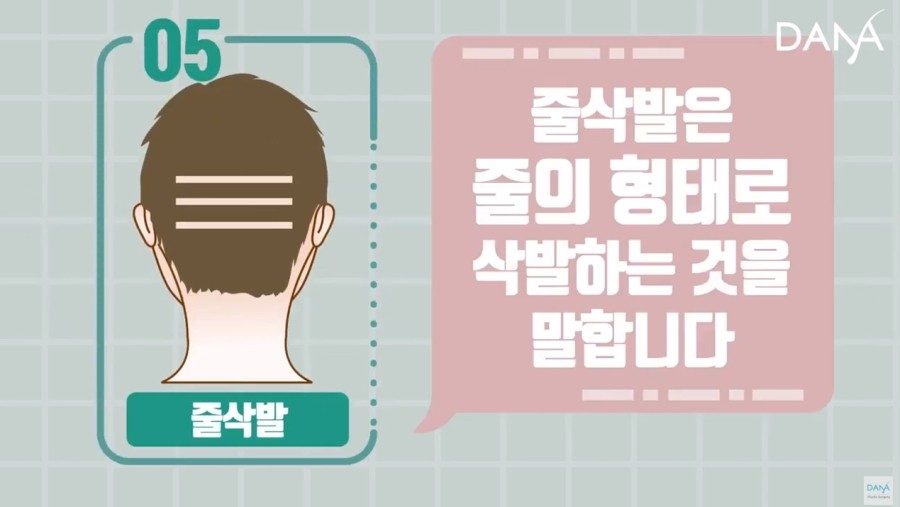 비절개 모발이식 시 삭발방법 종류 관련 이미지 9
