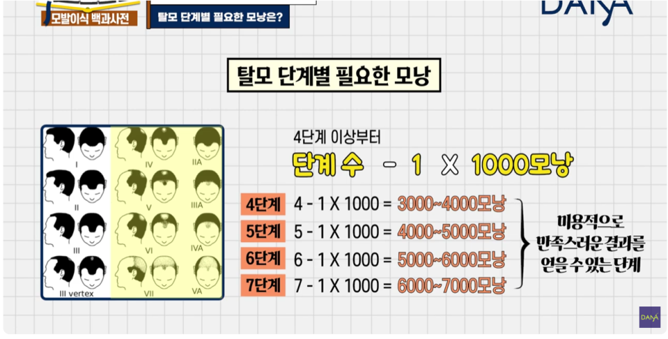 체모이식 체모를 활용한 단계별 대량이식 관련 이미지 11