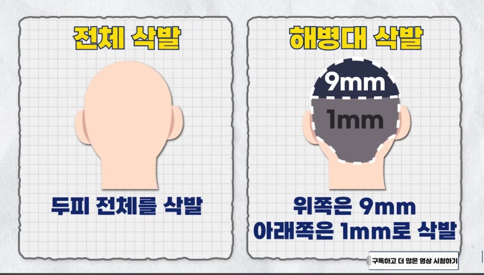 모발이식 수술 시 삭발 종류 관련 이미지 11
