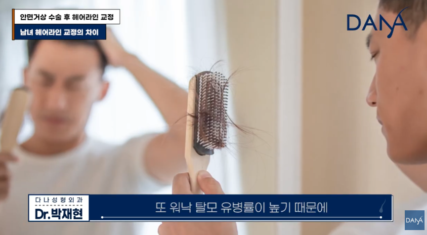 안면거상술 후 흉터와 헤어라인 변형, 자연스럽게 해결하는 방법 관련 이미지 27