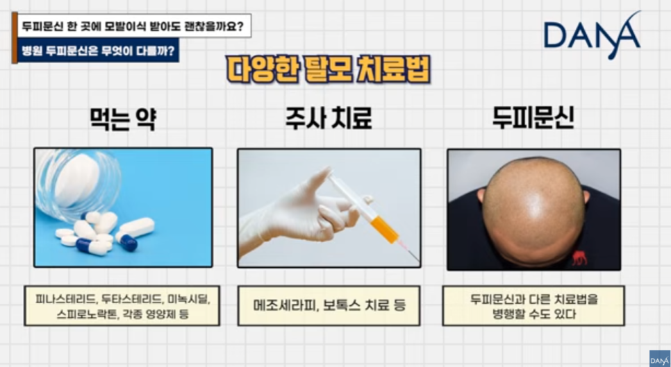 헤어라인 문신 망했는데 모발이식 가능할까? 생착률 걱정된다면 필수 체크 관련 이미지 13