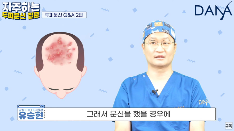 Scalp Micropigmentation: Is the Procedure Possible if You Have Seborrheic Scalp Dermatitis? image 4