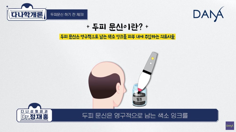 두피문신 전, 꼭 알아봐야 할 사항들 관련 이미지 1