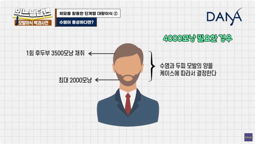 체모이식 체모를 활용한 단계별 대량이식 관련 이미지 16