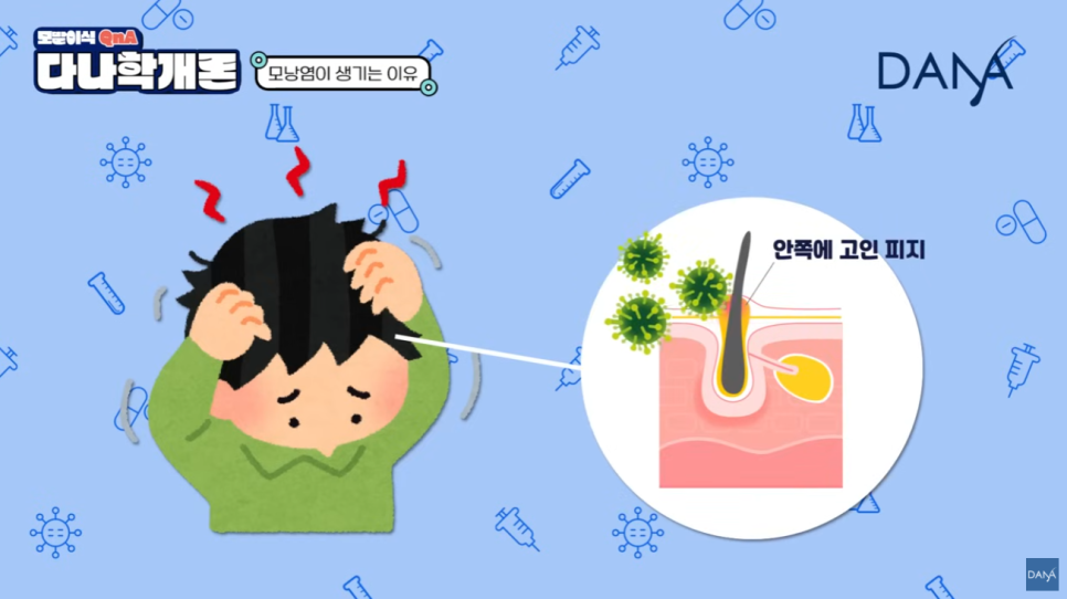 모발이식 후 모낭염, 수술 실패일까? 원인과 대처 꿀팁! 관련 이미지 11