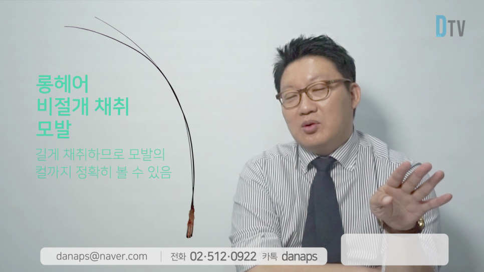 If You Want Natural Results, Long-Hair Non-Shaven Non-Incisional Hair Transplantation image 19